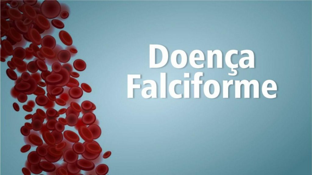 Pessoas com doença falciforme podem receber benefícios por incapacidade Fonte: https://previdenciarista.com/blog/pessoas-com-doenca-falciforme-podem-receber-beneficios-por-incapacidade/