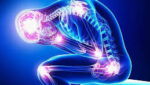 fibromialgia